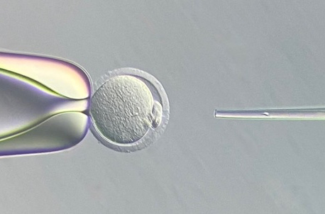 Microscope image of spermatazoa microinjection using a Microtul custom micropipette